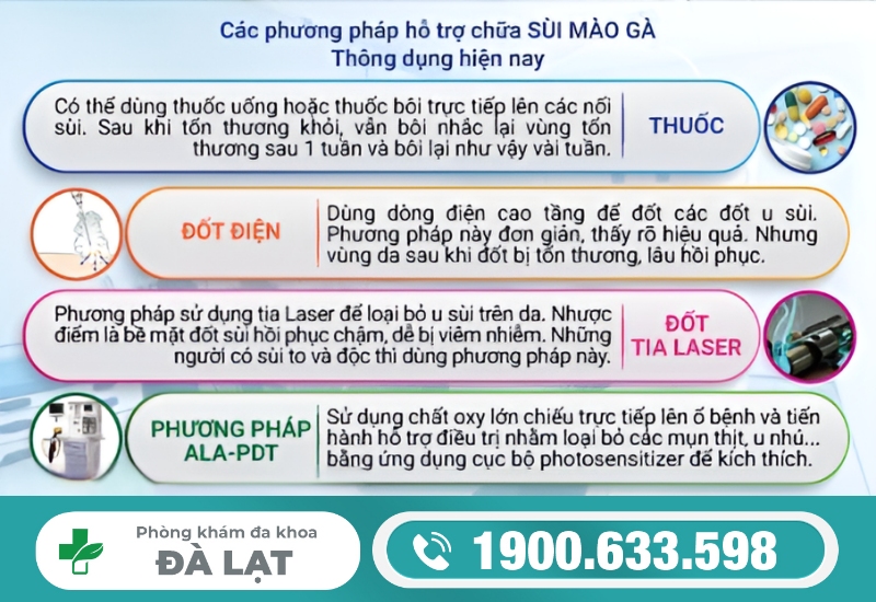 Hình ảnh minh họa